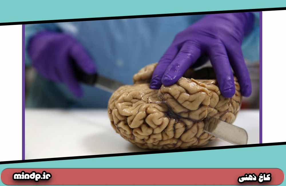 چند عامل کشنده حافظه (بلند و کوتاه مدت)